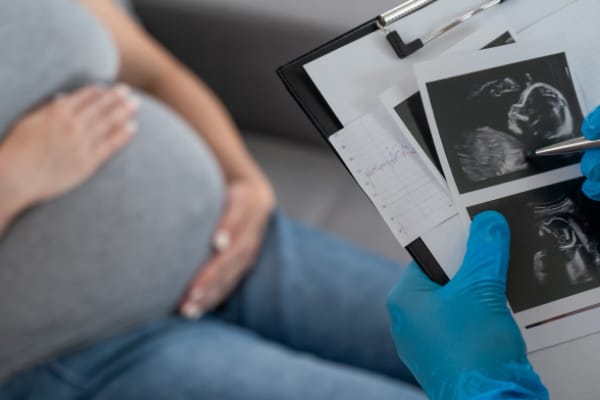 A pregnant women with the prenatal screening images illustrate Obstetrics & Gynaecology.