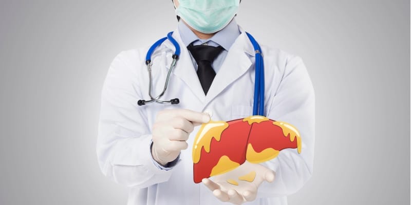 A medical professional holding a representation of hepatic steatosis to explain what is fatty liver and its impact on health.
